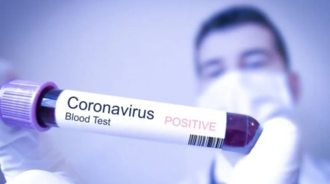Hati- Hati Virus Corona, Berikut Ini Pertolongan Pertama Untuk Mengatasinya