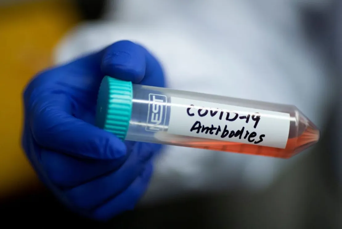 Studi: Antibodi Corona Dapat Bertahan Setidaknya 4 Bulan. Ini Penjelasannya