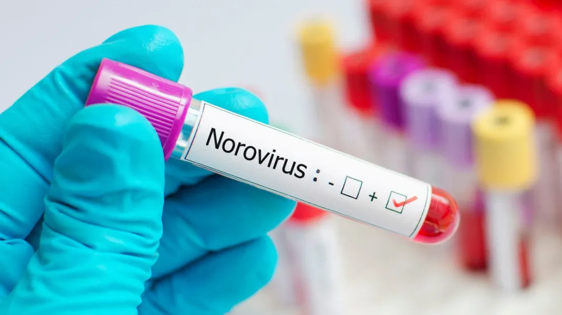 Apa itu Norovirus? Virus yang Menyerang China Di Tengah Pandemi