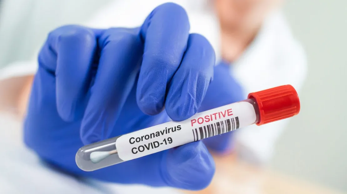 Benarkah Covid-19 Diprediksi Jadi Endemik Seperti Flu?