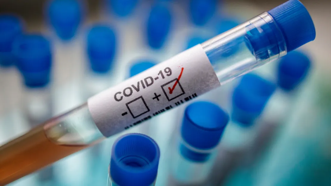 Meningkatkan Imun Tubuh Saat Terinfeksi Covid-19, Ini 6 Tipsnya