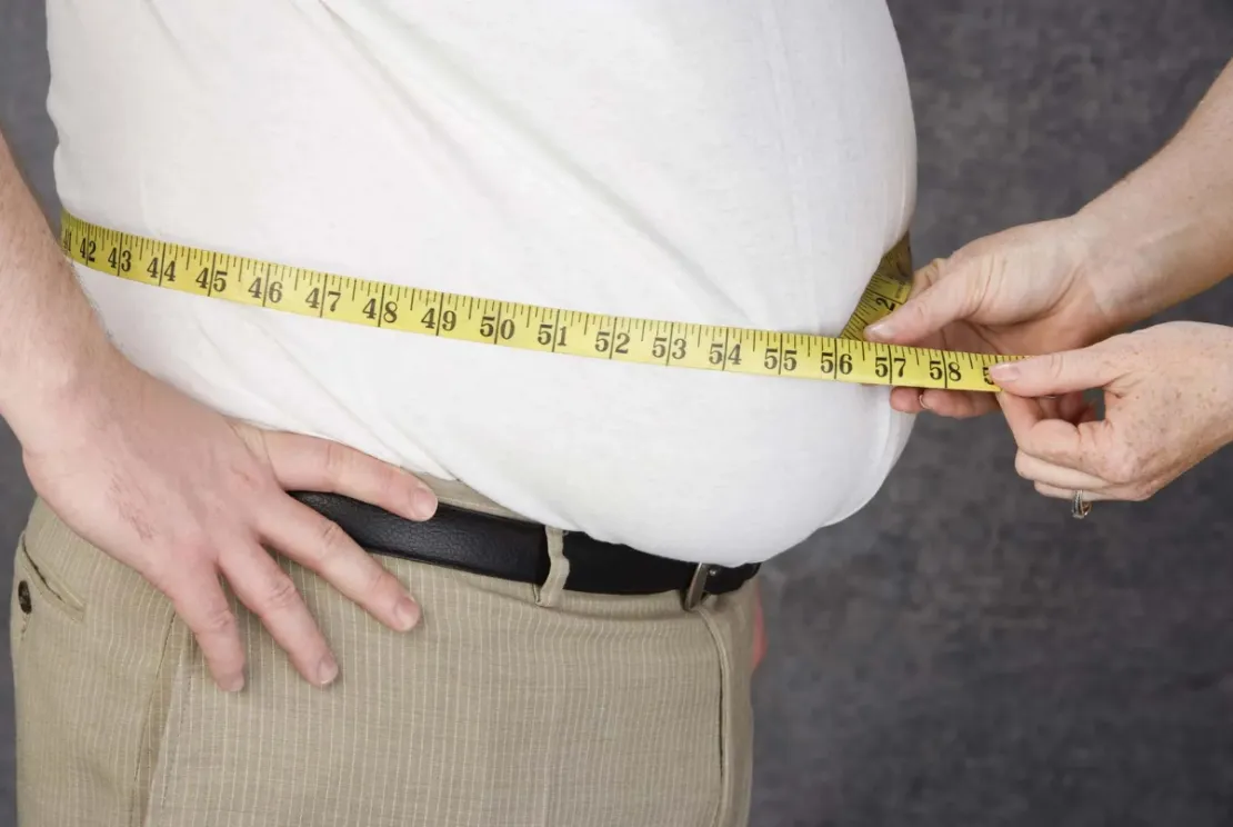 3 Penyebab Obesitas, Tak Cuma Makan Berlebihan!