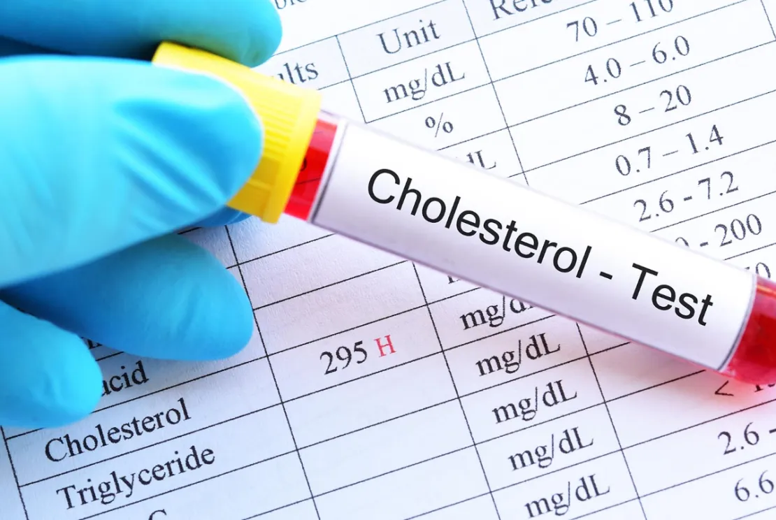 Jaga Kadar Kolesterol Tetap Aman, Ini 4 Cara yang Perlu Dilakukan