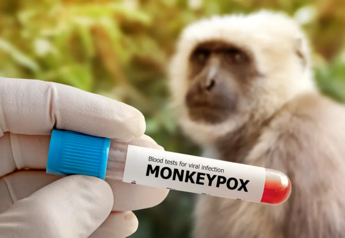 Mengenal Apa Itu Monkeypox, Gejala & Pengobatannya Berikut!