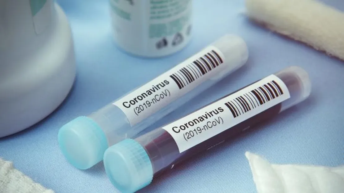 Kolaborasi Pemerintah dan UNAIR Untuk Kembangkan Kombinasi Obat Corona