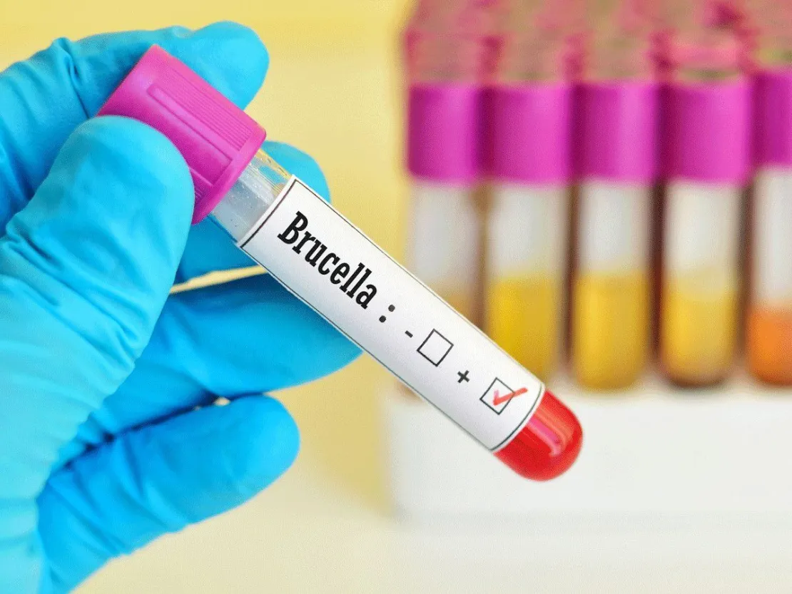 Mengenal Brucellosis, Penyakit yang Menyerang Warga China Di Tengah Pandemi