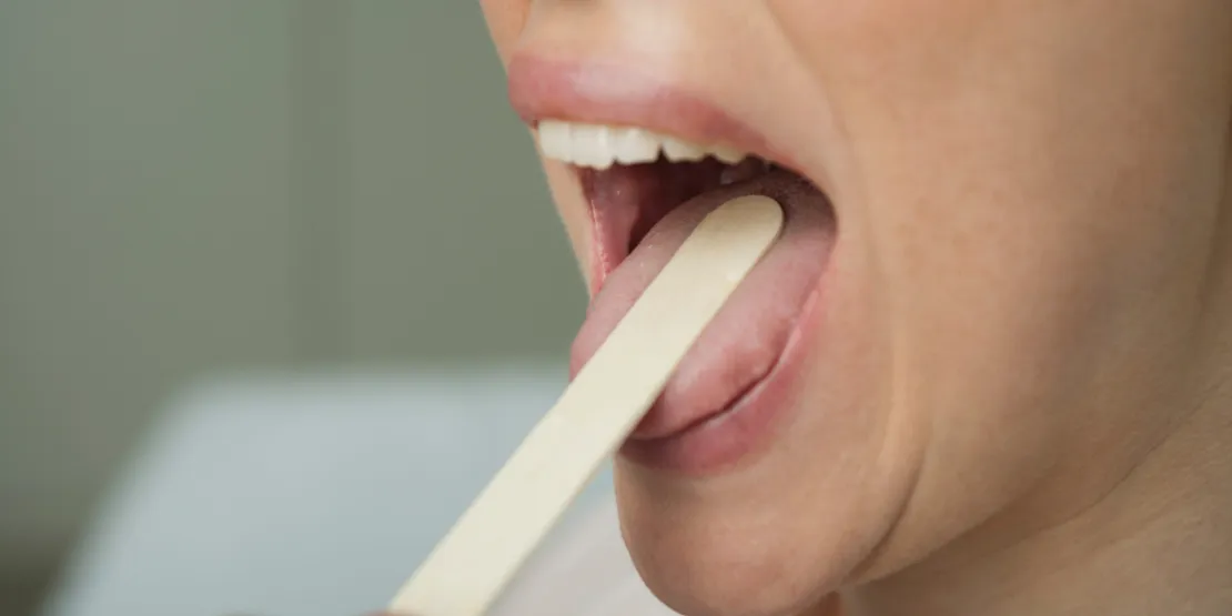 Covid Tounge: Gejala Corona yang Mirip Sariawan