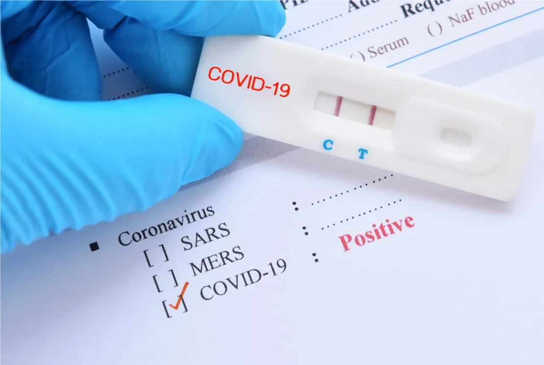Positif Covid-19 Usai Vaksinasi Pertama, Apa yang Perlu Dilakukan?
