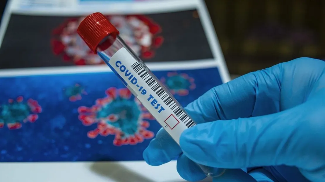 Antibodi Penyintas Covid-19 Dapat Bertahan Sampai 12 Bulan