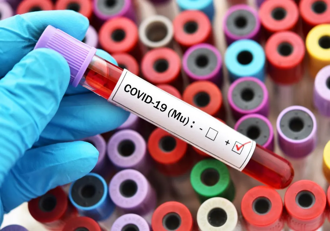 Kenali Mu, Varian Baru Virus Corona yang Sedang Dipantau WHO