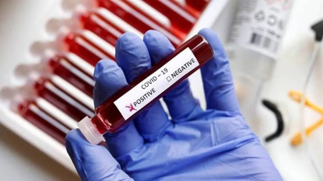 Kasus Covid-19 Menurun Drastis, Ini Pendapat Epidemiolog
