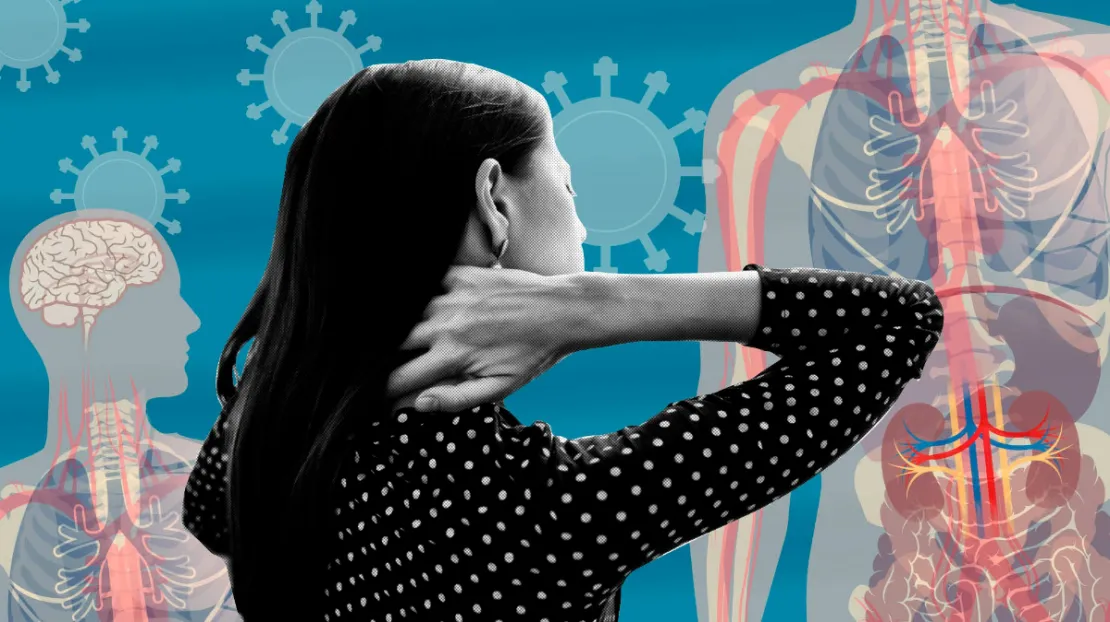 5 Fakta Soal Post-Covid Syndrome, Bisa Sebabkan 50 Gejala Lho!