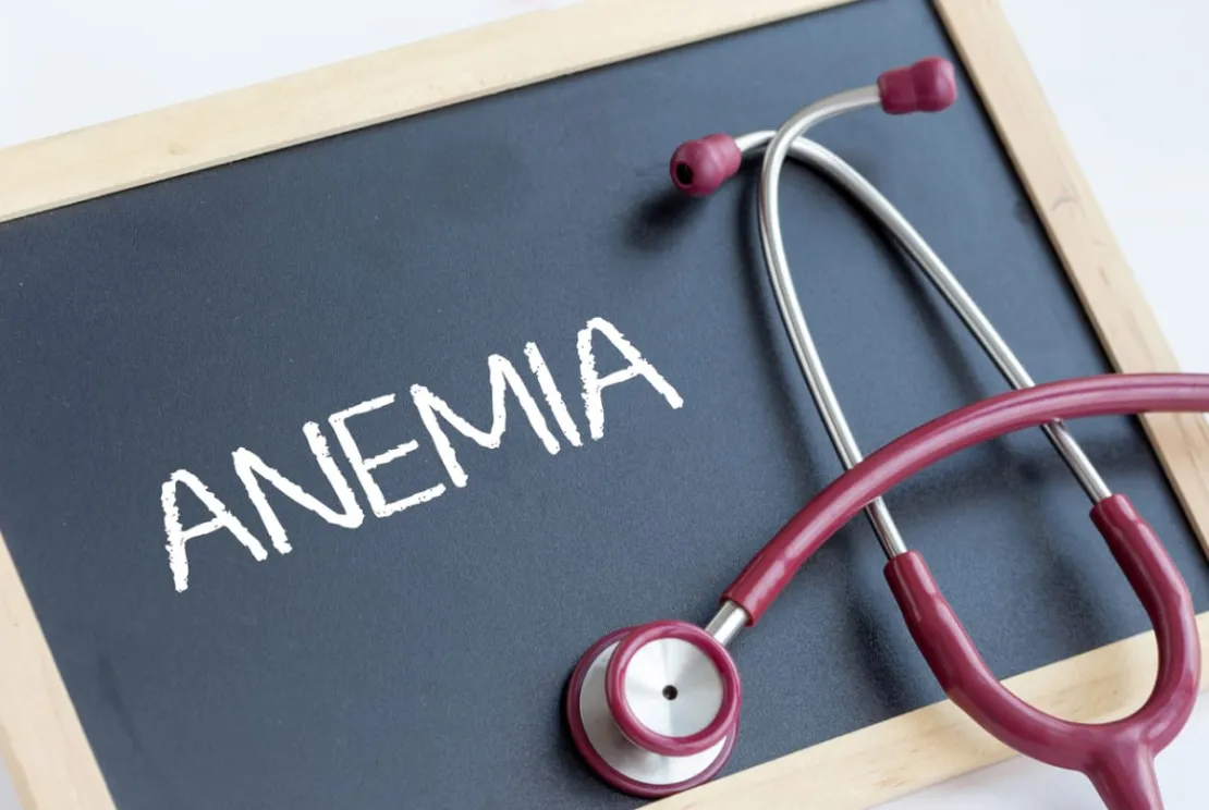 Kenali Pentingnya Asupan Vitamin C Buat Penderita Anemia