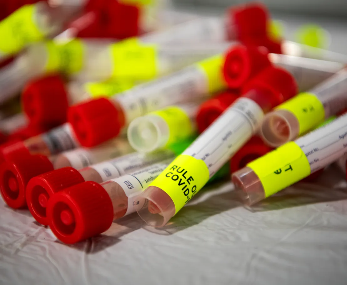 Varian Virus Covid-19: Berisiko Tinggi Meningkatkan Kasus Reinfeksi