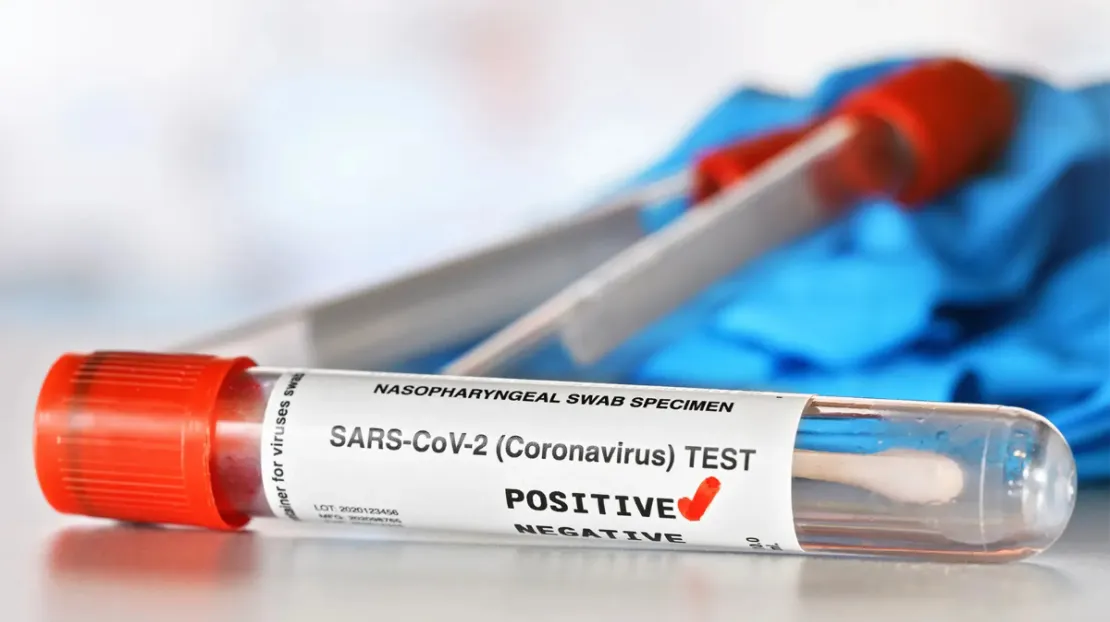Pernah Positif COVID-19, Apakah Kebal Terhadap Varian Baru?