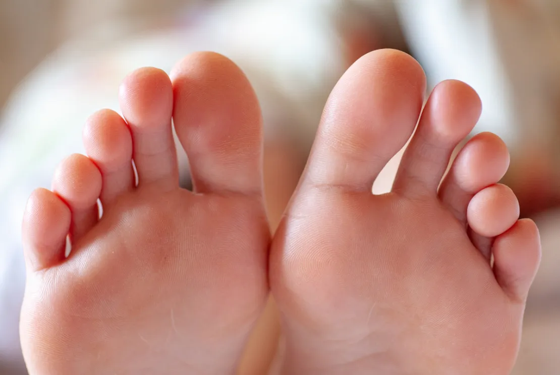 Ada Covid Toes, Inflamasi pada Jari Ketika Terinfeksi Corona