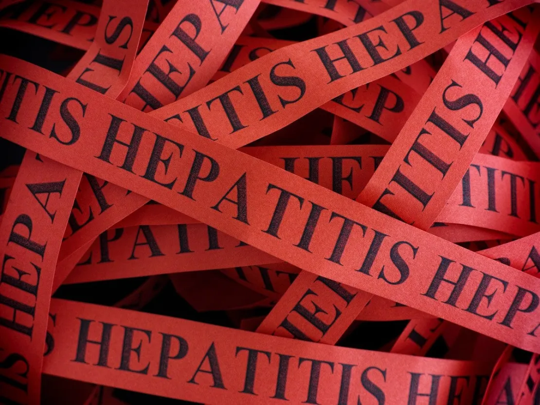 Waspadai Hepatitis Akut Misterius, Cegah dengan Cara Ini!