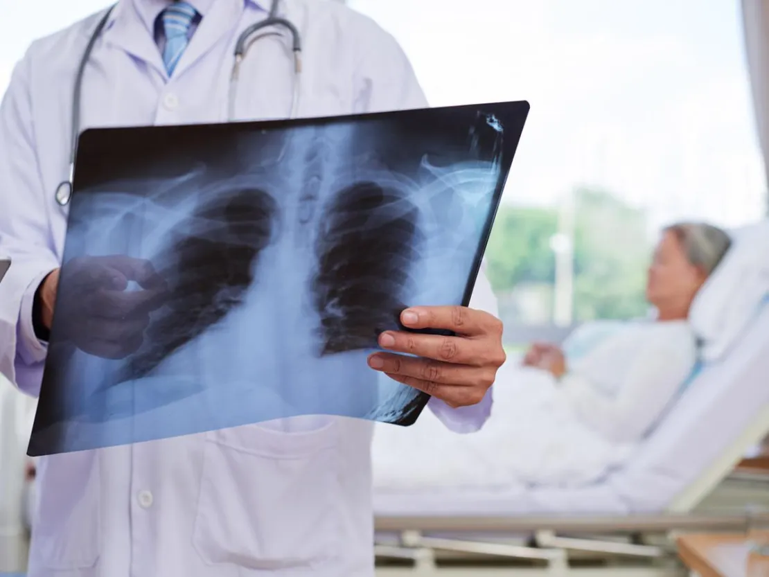 Penderita Pneumonia Bisa Alami Sesak Nafas, Mengapa Demikian?