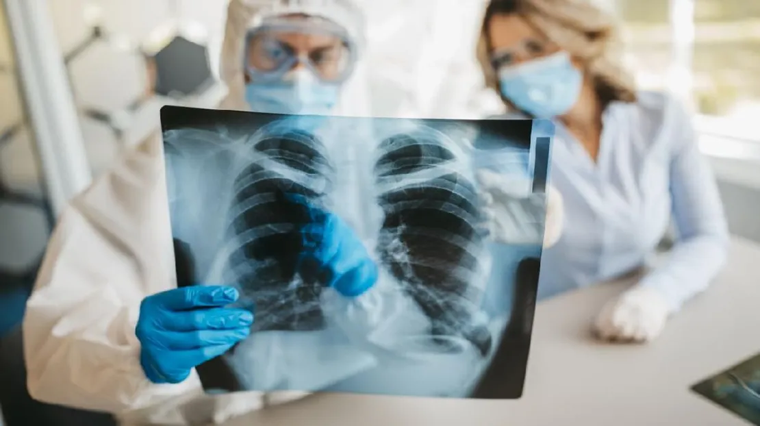 Studi: Penyintas Covid-19 dapat Alami Penuaan Organ Tubuh