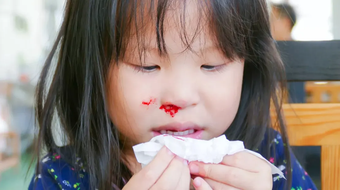 Kenali Penyebab Mimisan pada Anak dan Tips Mengatasinya