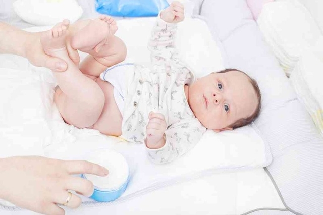 5 Cara Mengatasi Ruam Popok Pada Bayi