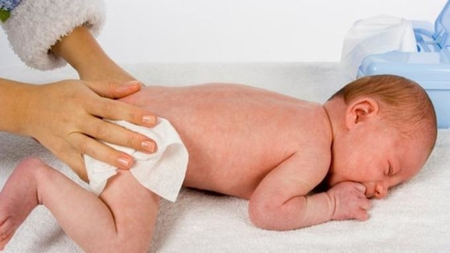 Manfaat Petroleum Jelly Untuk Kulit Bayi