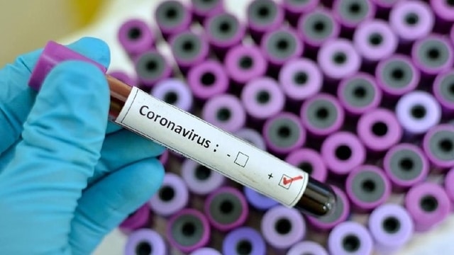 Musim Panas Dapat Membunuh Virus Corona. Benarkah?