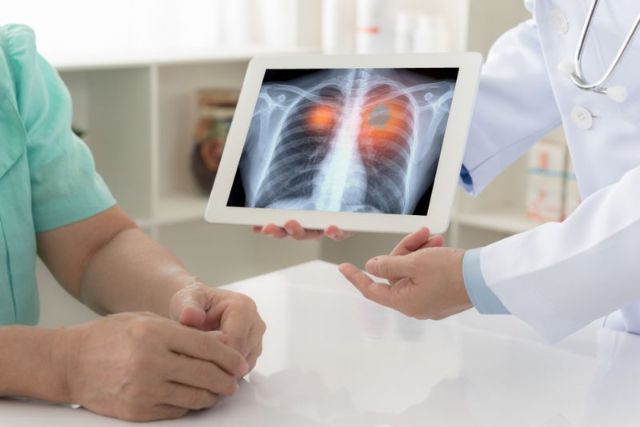 Covid-19 Sebabkan Pneumonia, Siapa yang Rentan Terserang?
