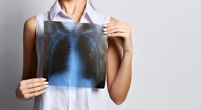 Sama- Sama Menyerang Paru, Tapi Apa Perbedaan Pneumonia dan Bronkitis?