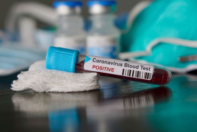 Mengenal Rapid Test Untuk Deteksi Virus Corona