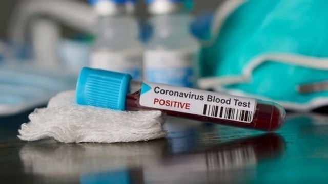 Deteksi Covid-19, Kenali Perbedaan PCR dan Rapid Test