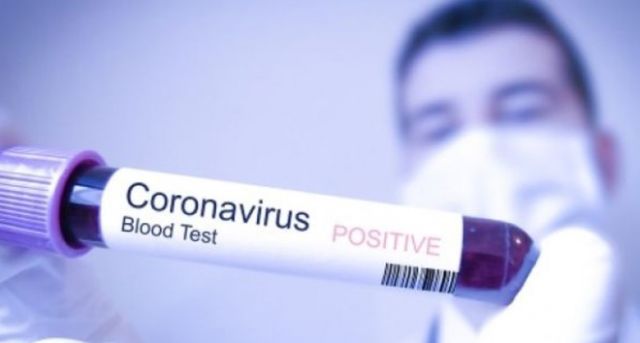 Positif Corona Lagi Usai Sembuh. Bisakah Terjadi?