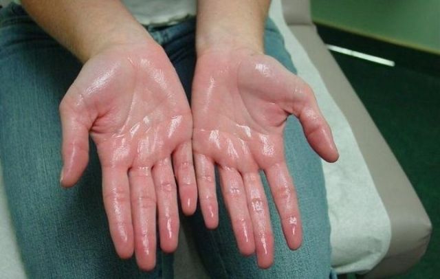 5 Kesalahan Umum Saat Mencuci Tangan yang Wajib Dihindari