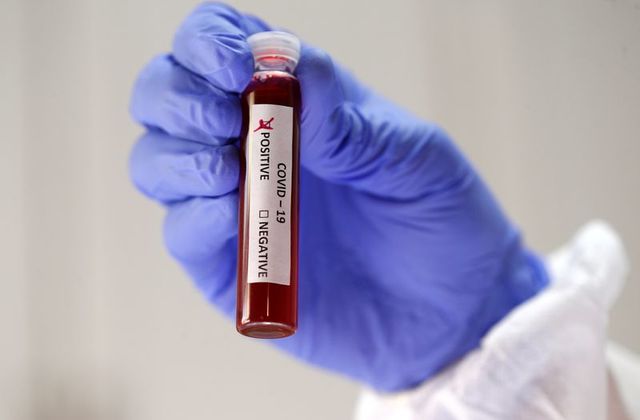 Berapa Lama Carrier Virus bisa Menularkan ke Orang Lain?