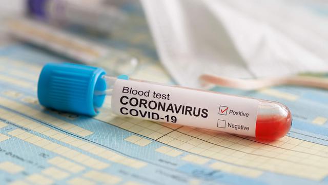 Reinfeksi Virus Corona: Ini 5 Hal yang Perlu Diketahui