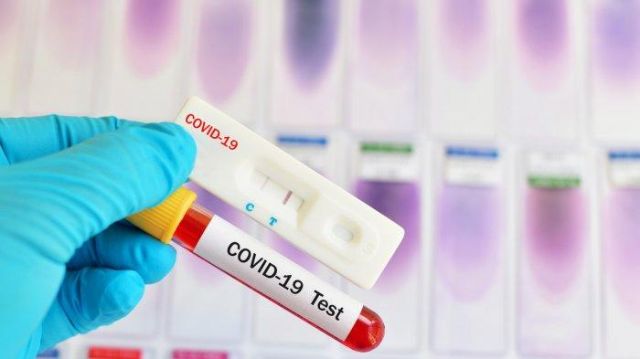 Sama-Sama Pakai Metode Swab, Lebih Akurat PCR atau Antigen?