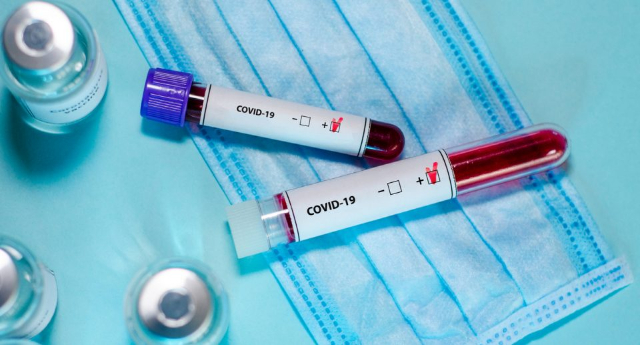 WHO: Ada 3 Alasan Penting Mengapa Asal Usul Corona Perlu Diketahui