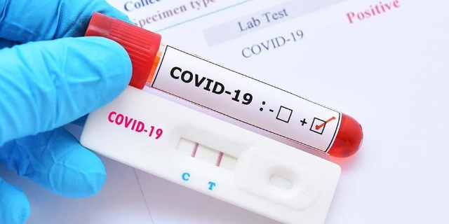 Reinfeksi Covid-19 Bisa Terjadi, Apa Saja Hal yang Harus Diketahui?