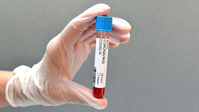 Tertular Virus Corona dan Alami Gejala? Lakukan Pertolongan Pertama Ini!