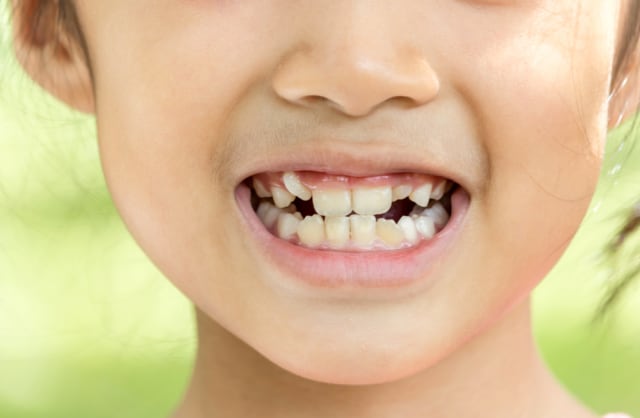 Mengenal Manfaat Vitamin D yang Juga Dapat Tingkatkan Imun Si Kecil