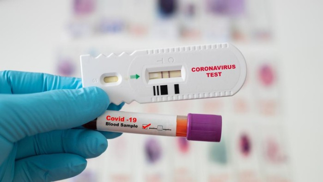 Hasil Tes Antigen Positif! Apakah Perlu Tes Dengan PCR?