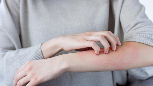 Ini 4 Gejala Covid-19 Pada Penderita Diabetes yang Perlu Diperhatikan