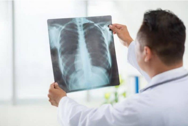 Ini 4 Gejala Covid-19 Pada Penderita Diabetes yang Perlu Diperhatikan