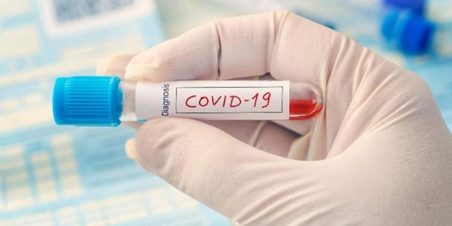 Ada Lho yang Nekat Divaksin Saat Positif Covid-19, Bahaya Gak Ya?