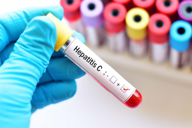 Bukan Hanya A dan B, Lho! Ini 5 Jenis Hepatitis yang Perlu Diwaspadai