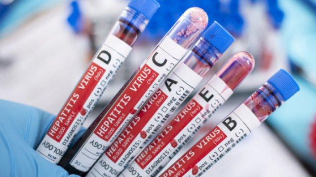 Bukan Hanya A dan B, Lho! Ini 5 Jenis Hepatitis yang Perlu Diwaspadai