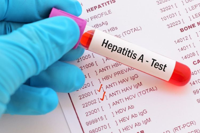 Bukan Hanya A dan B, Lho! Ini 5 Jenis Hepatitis yang Perlu Diwaspadai