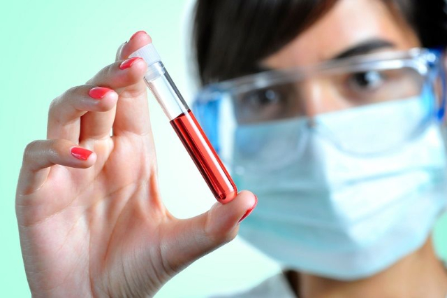 Ternyata, Begini Cara Kerja Antibodi dalam Melawan Virus!
