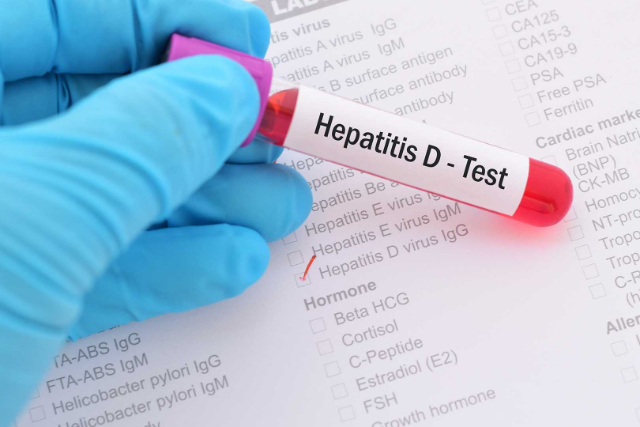 Bagaimana Cara Hepatitis Akut Menyebar? Begini Penjelasannya