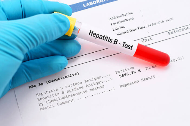Bagaimana Cara Hepatitis Akut Menyebar? Begini Penjelasannya